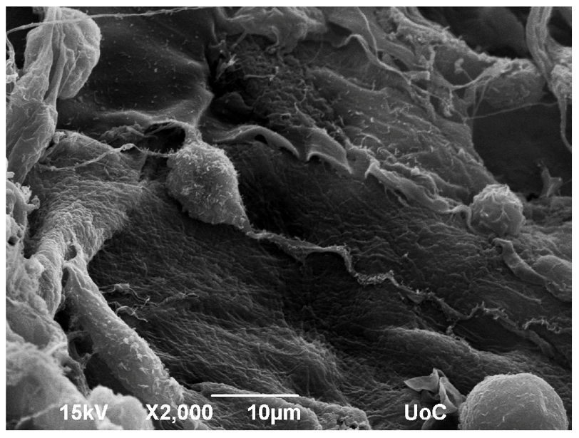 metaptyxiaka-pms-neuroepistimes-06