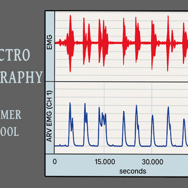 Electromyography Summer School [10-13 June 2025]
