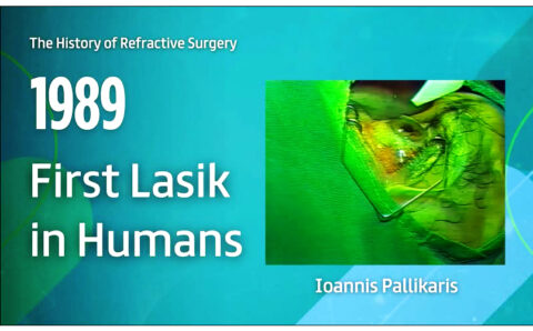 H τεχνική lasik στη διαθλαστική χειρουργική υπό τον καθηγητή κ. Ιωάννη Παλλήκαρη, αναγνωρίστηκε ως σταθμός στην ιστορία της παγκόσμιας Οφθαλμολογίας!