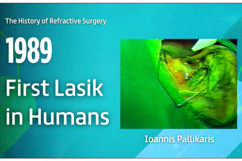 H τεχνική lasik στη διαθλαστική χειρουργική υπό τον καθηγητή κ. Ιωάννη Παλλήκαρη, αναγνωρίστηκε ως σταθμός στην ιστορία της παγκόσμιας Οφθαλμολογίας!