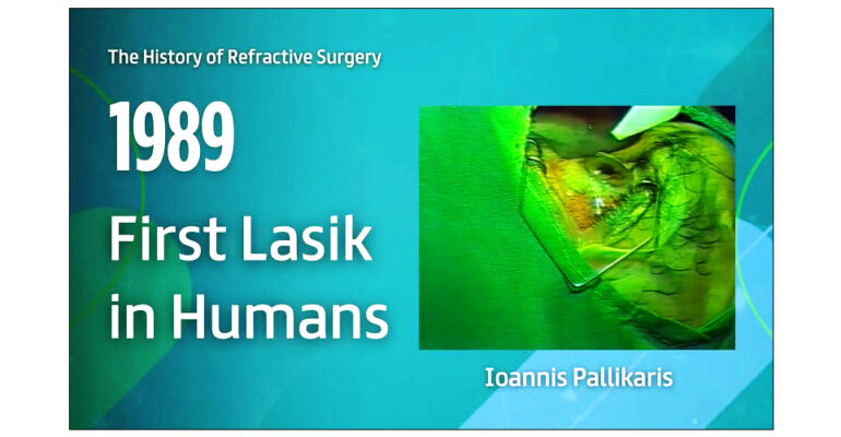H τεχνική lasik στη διαθλαστική χειρουργική υπό τον καθηγητή κ. Ιωάννη Παλλήκαρη, αναγνωρίστηκε ως σταθμός στην ιστορία της παγκόσμιας Οφθαλμολογίας!