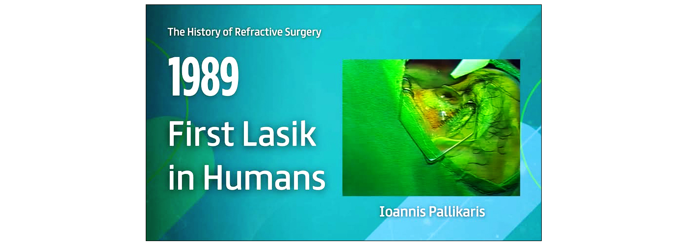 H τεχνική lasik στη διαθλαστική χειρουργική υπό τον καθηγητή κ. Ιωάννη Παλλήκαρη, αναγνωρίστηκε ως σταθμός στην ιστορία της παγκόσμιας Οφθαλμολογίας!