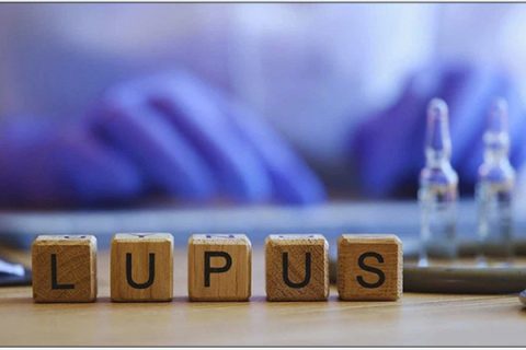 2026-03-19-patris-gr3