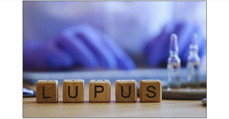 2026-03-19-patris-gr3