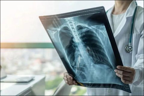 2026-03-24-fymatiosi-varsamidi-patris