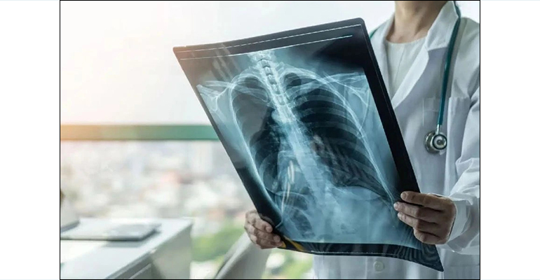 2026-03-24-fymatiosi-varsamidi-patris